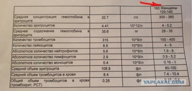 Как глупо и легко можно уехать на тот свет