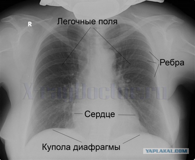 Любовь зла 18+