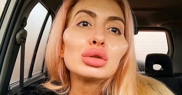 Хинштейн забраковал варианты памятника куряночке и объявил голосование