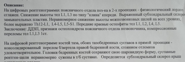 Защемило спину