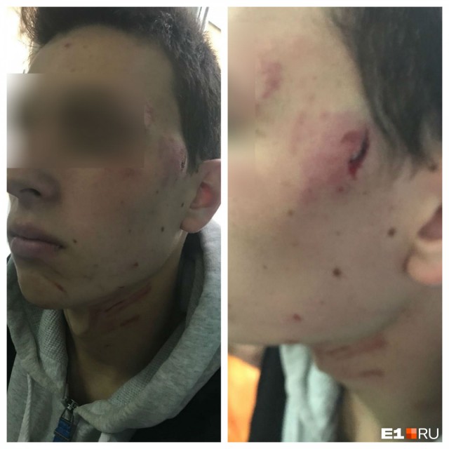 «Понимал, что ребенку капец»: на уральца завели уголовное дело за то, что заступился за сына в драке