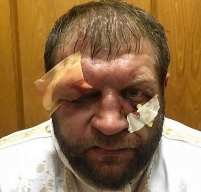 Кадыров побил Емельяненко