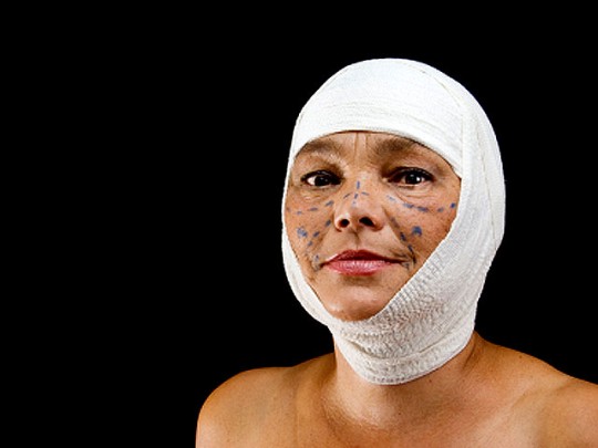 10-ка самых популярных пластических операций