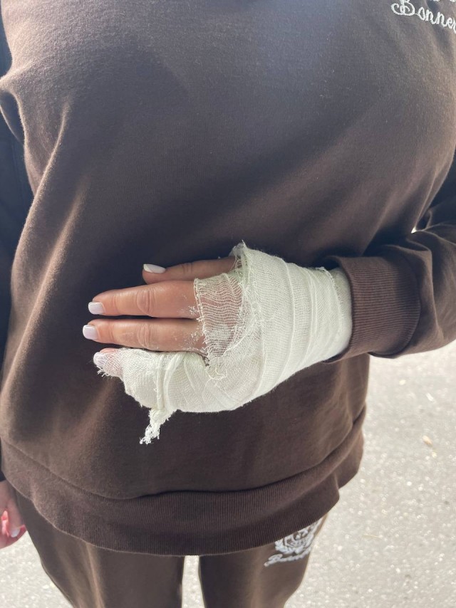 В подмосковном Одинцово банда на самокатах напала и ограбила женщину
