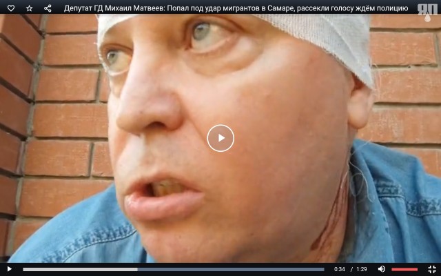 Депутат ГД Михаил Матвеев: Попал под удар мигрантов в Самаре, рассекли голову ждём полицию