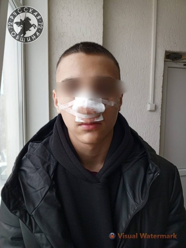 В Тюменском лицее 16-летний мигрант сломал нос 13-летнему ученику