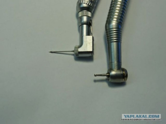 Пломбирование зубов и корневого канала