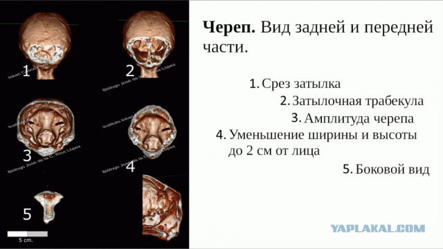 Детальный анализ мумий инопланетян найденных на плато Наска