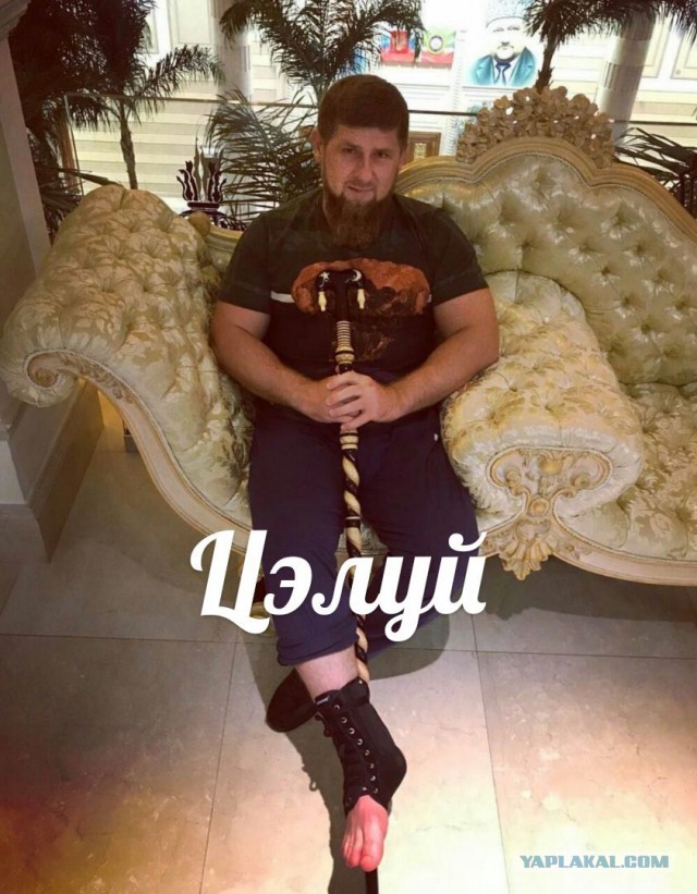 Кадырову сломали ногу