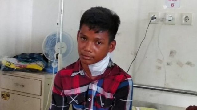 Рыба выпрыгнула из воды и проткнула шею подростку из Индонезии