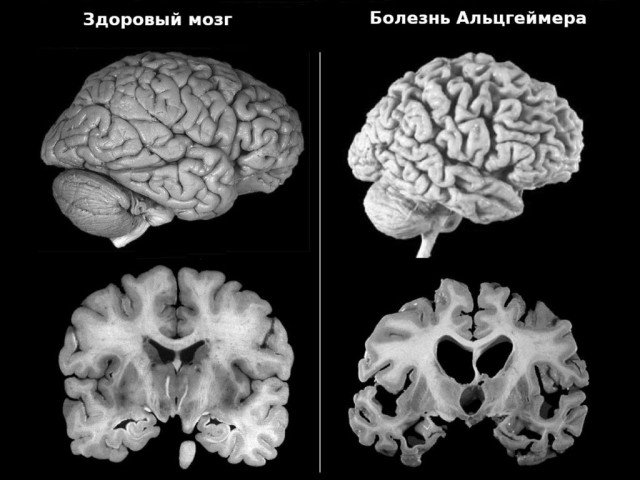Хобби хорсинг, Квадробинг, Ятулюсинг.