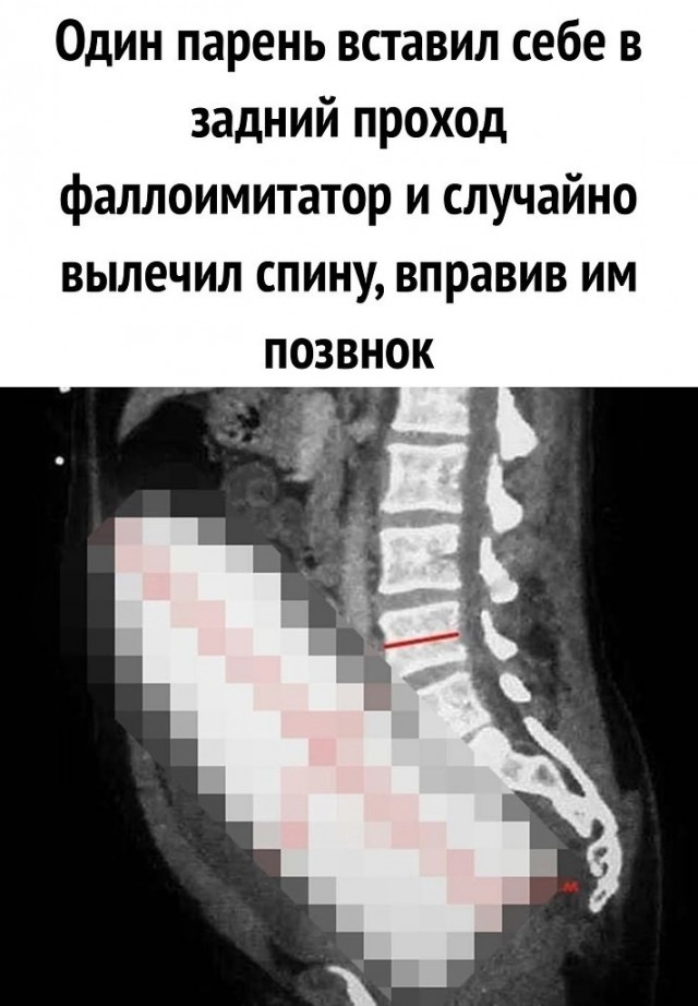 Удилдизировано.
