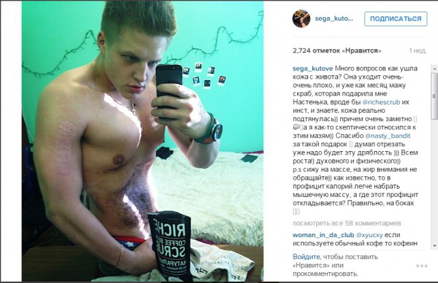 «Потерял ногу, но не потерял себя»