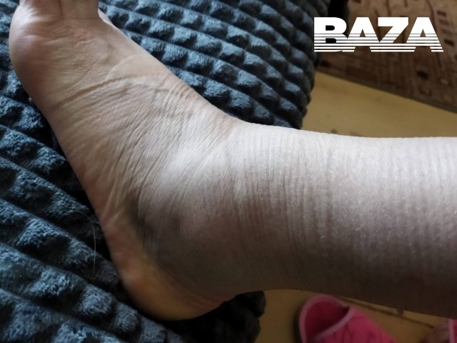 Хирург обматерил пациентку и ее мужа в больнице под Волгоградом