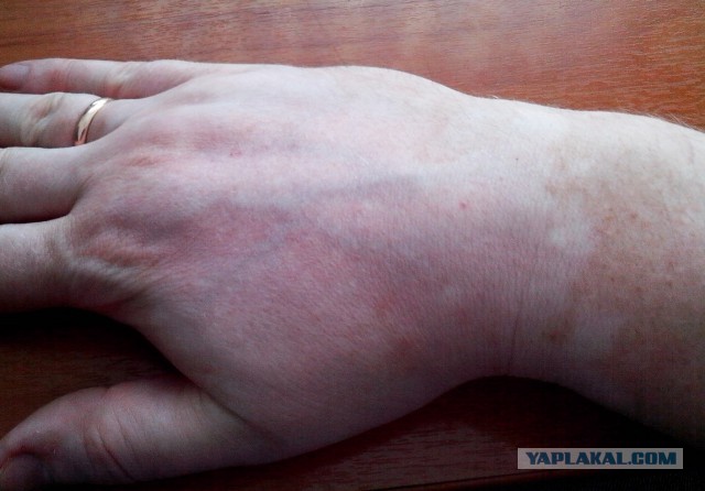 Шантель Винни