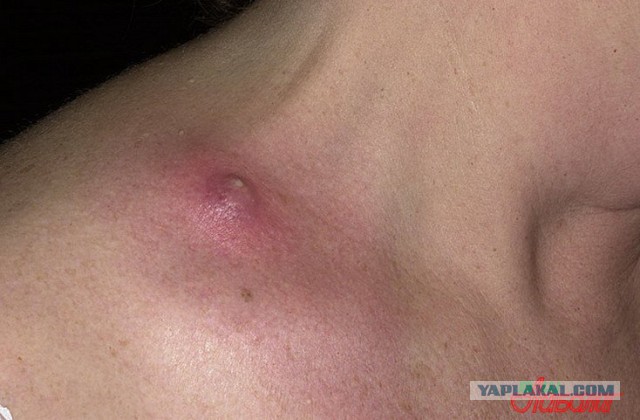 Прощай белая полоска