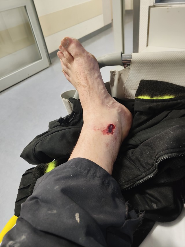 Самокат зло или ?