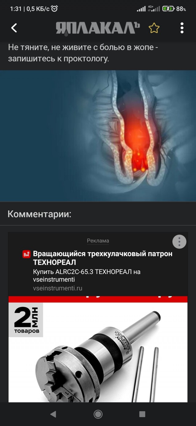 Геморрой 2.0