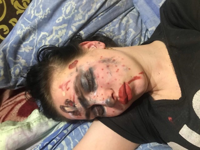 Таких друзей за х.... и в болото