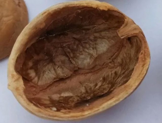 Черепная коробка