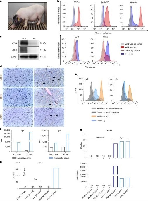 Ура, товарищи, это произошло! Пересадка генно-модифицированной свиной печени в человека, теперь можно бухать..