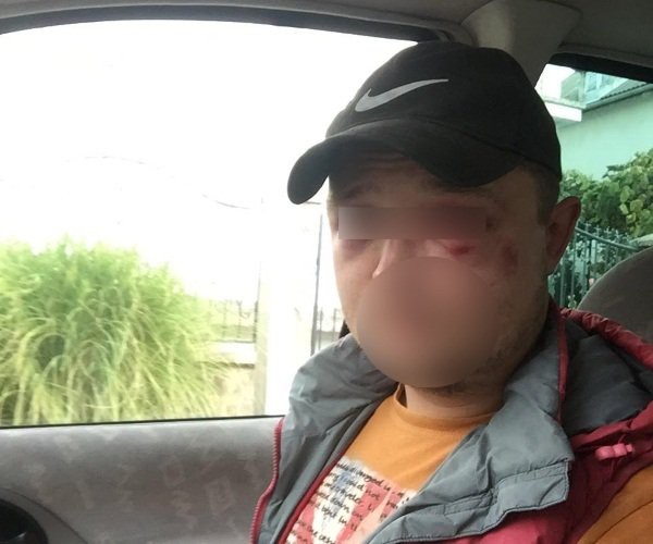 Жгите им машины, бросайте их в канаву!