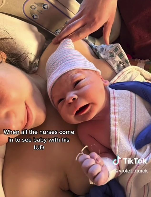 Ребенок родился с противозачаточной внутриматочной спиралью в руке