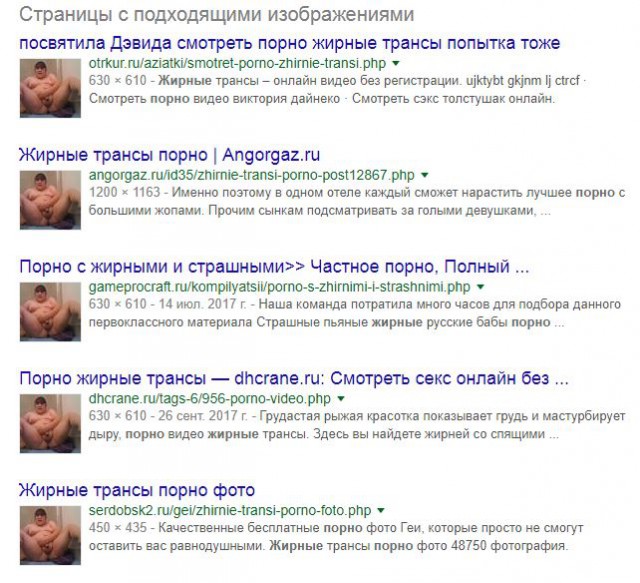 Типы мужских сисек