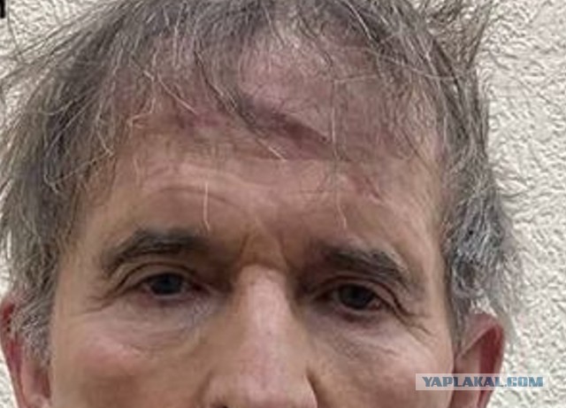 К вопросу об обмене Медведчука