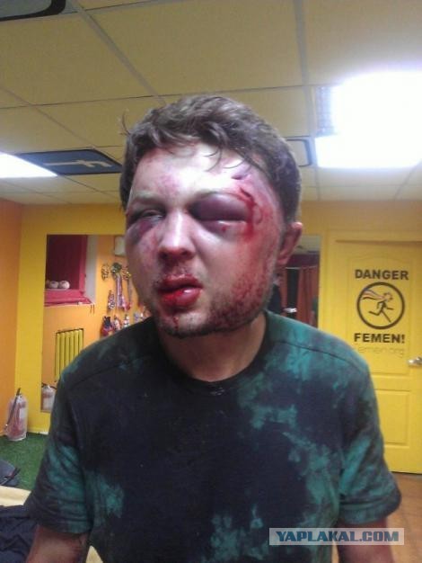 В центре Киева жестоко избили политолога Femen