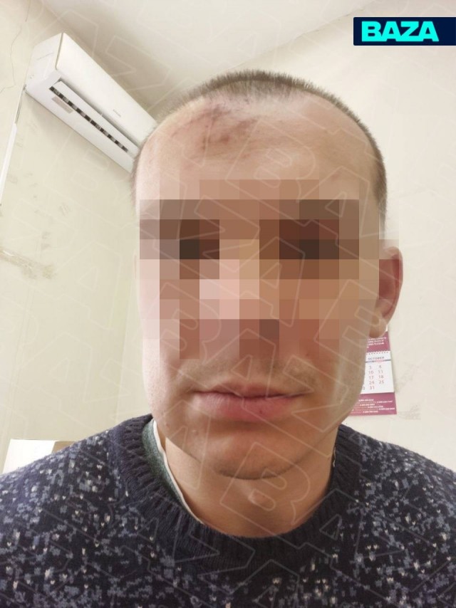 В Подмосковье интернет-тролля заманили на шашлыки ради избиения в прямом эфире