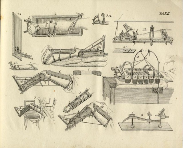 Медицинские инструменты 19 го века