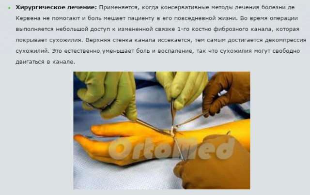 Когда идиотам делать нечего: люди делают себе вывих большого пальца и делятся результатами