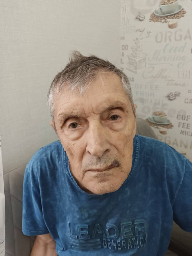 78-летнего дедушку с альцгеймером жестоко травмировали в частном подмосковном доме престарелых