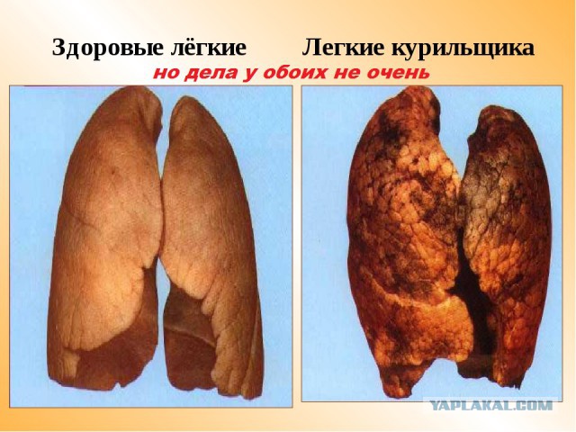Курение. Попробуем разобраться