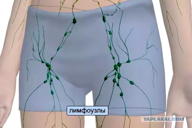 О мужских плавках и воинственном пуританстве