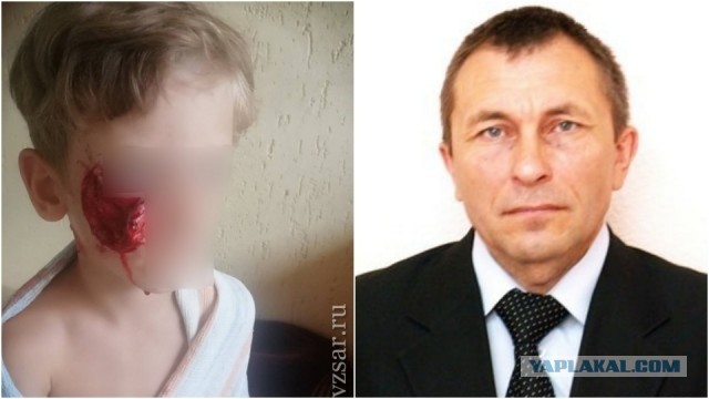 В Саратове суд вынес приговор владельцу собаки, покусавшей ребёнка