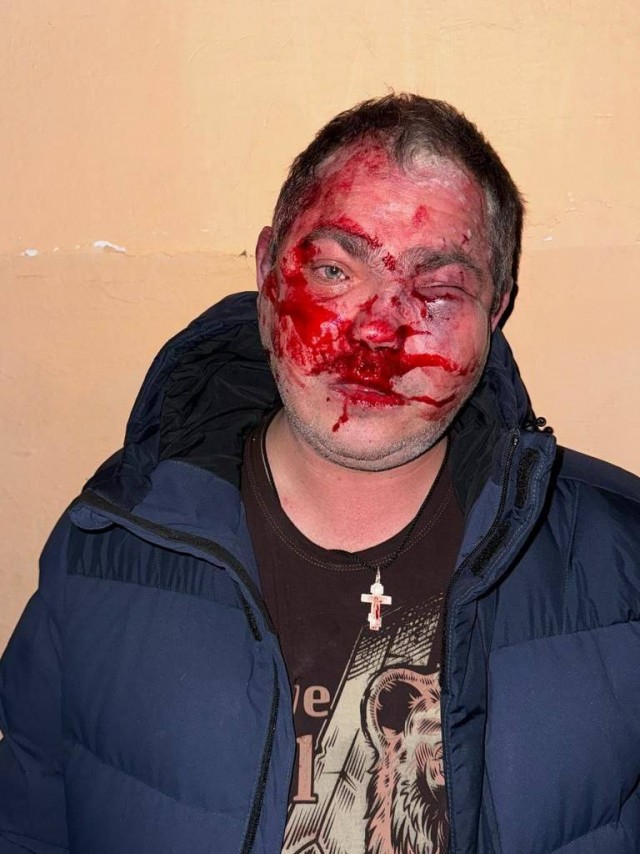 В Крыму избили посетителей кафе
