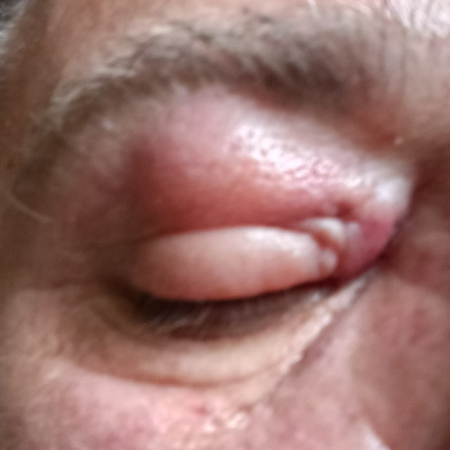 У меня теперь глаз