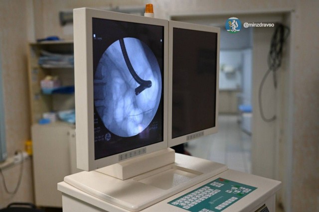 Застрявшая сосиска между желудком и пищеводом чуть не угробила пенсионерку в Екатеринбурге