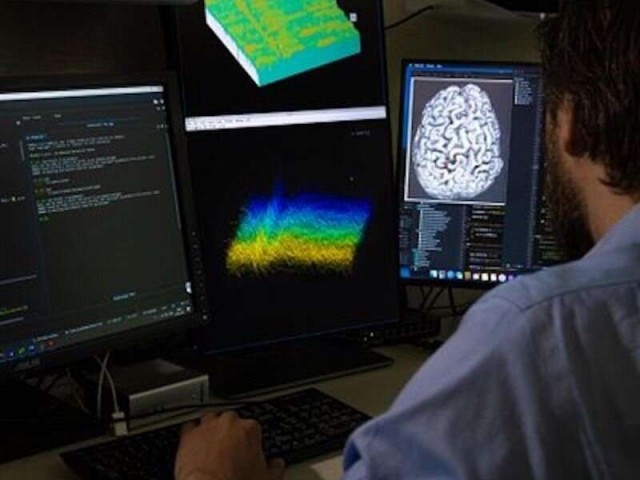 «Хочу пиво!», — парализованный мужчина смог заговорить с помощью мозгового импланта и интерфейса мозг-компьютер