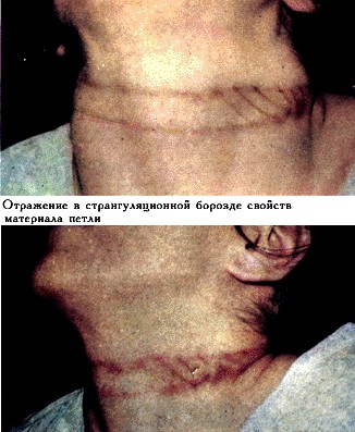 Мам, я в плену, но ты не плачь.