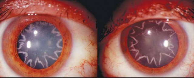 Отгадайте как получились такие глаза