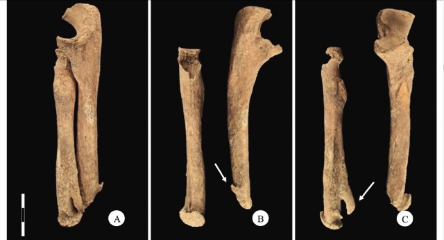 В Италии раскопали средневекового киборга с ножом вместо руки