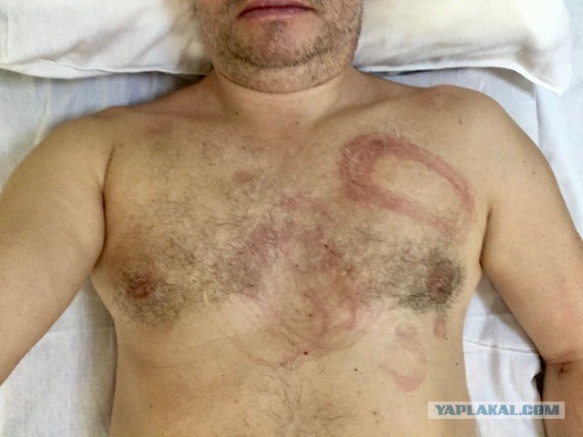 Один день разделил жизнь на до и после…