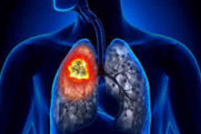 Ковид, Цифровая валюта и прочие радости