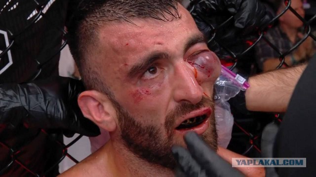 Номинанты на пенсию по Паркинсону и Альцгеймеру во всей красе.