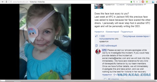 3-летнюю девочку выгнали из KFC из-за ее шрамов
