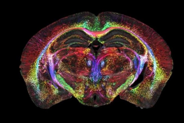 Физики улучшили качество снимков МРТ в 64 миллиона раз и рассмотрели отдельные клетки мозга