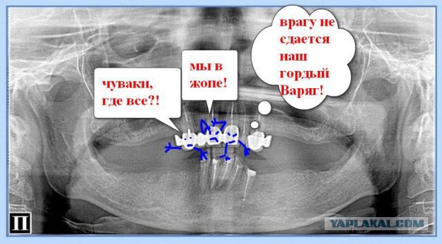 Стоматолог рассказывает о людях, которые выбрали дорогой телефон вместо лечения. Зубы VS iPhone 7